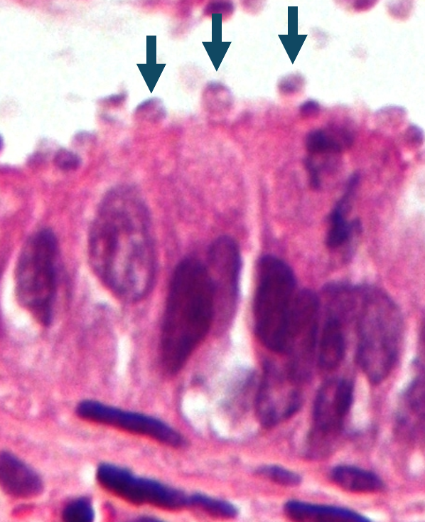 Kryptosporidiose Kolon